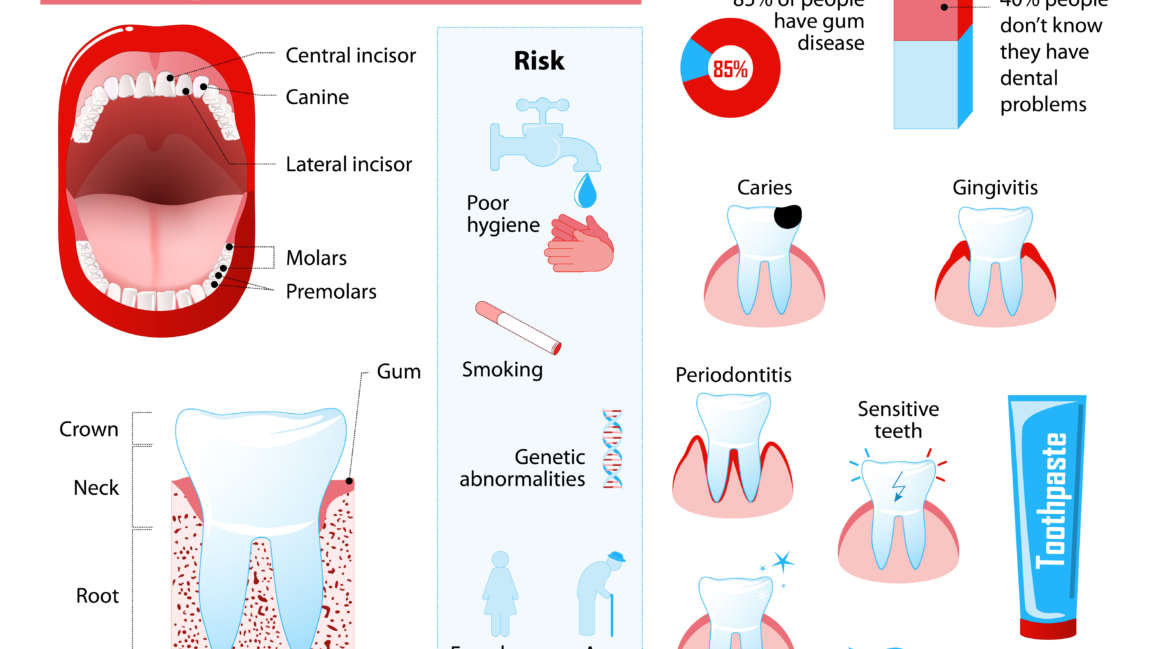 Dental Problemler
